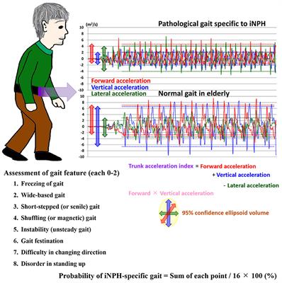 Gait Assessment Using Three-Dimensional Acceleration of the Trunk in Idiopathic Normal Pressure Hydrocephalus